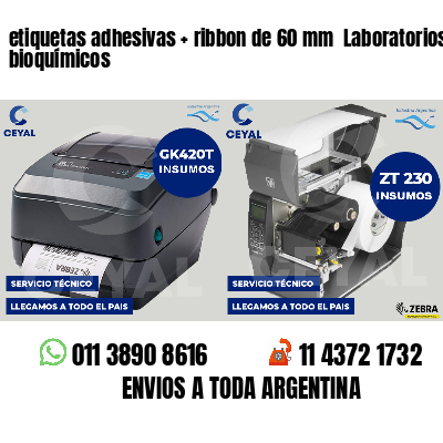 etiquetas adhesivas   ribbon de 60 mm  Laboratorios bioquímicos
