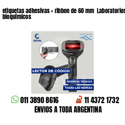 etiquetas adhesivas   ribbon de 60 mm  Laboratorios bioquímicos