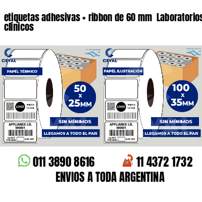 etiquetas adhesivas   ribbon de 60 mm  Laboratorios clínicos