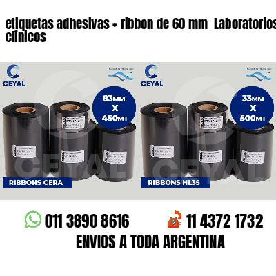 etiquetas adhesivas   ribbon de 60 mm  Laboratorios clínicos