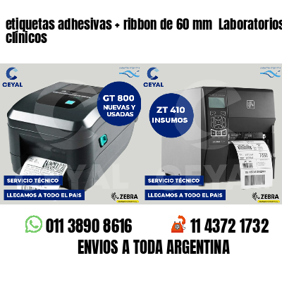 etiquetas adhesivas   ribbon de 60 mm  Laboratorios clínicos