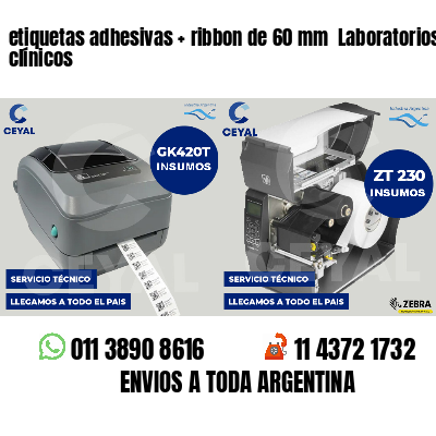 etiquetas adhesivas   ribbon de 60 mm  Laboratorios clínicos