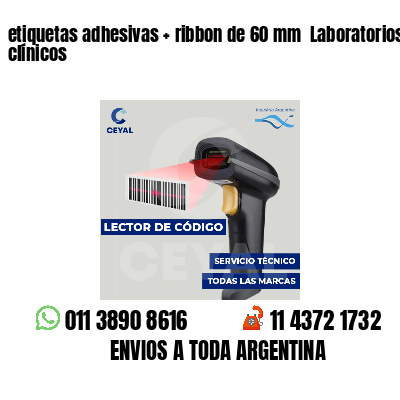 etiquetas adhesivas   ribbon de 60 mm  Laboratorios clínicos