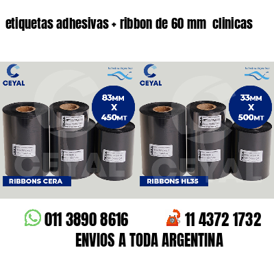 etiquetas adhesivas   ribbon de 60 mm  clinicas