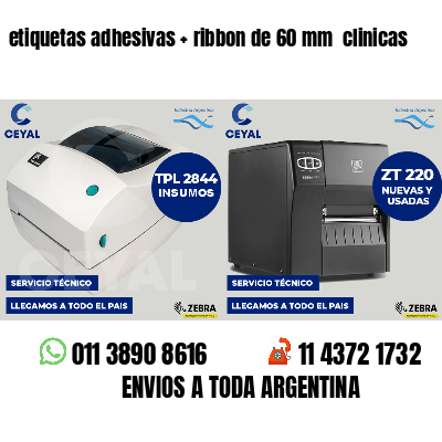 etiquetas adhesivas   ribbon de 60 mm  clinicas