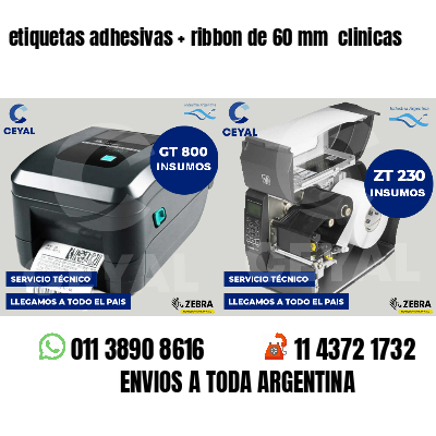 etiquetas adhesivas   ribbon de 60 mm  clinicas