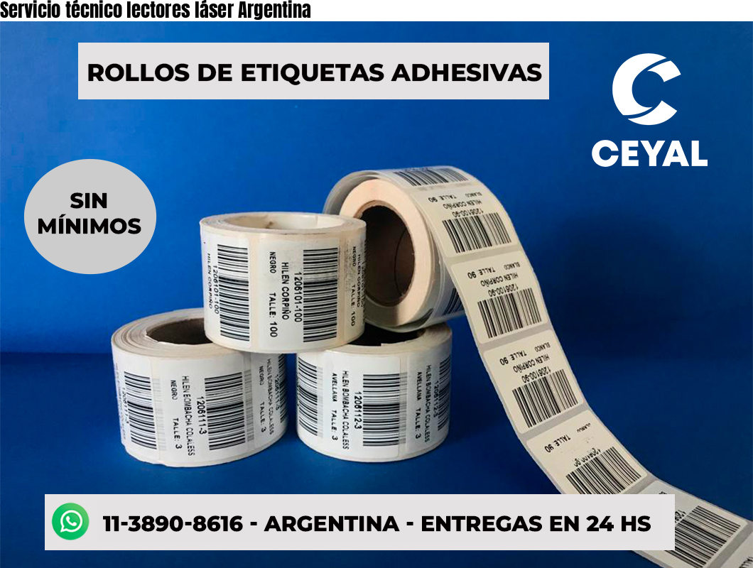 Servicio técnico lectores láser Argentina