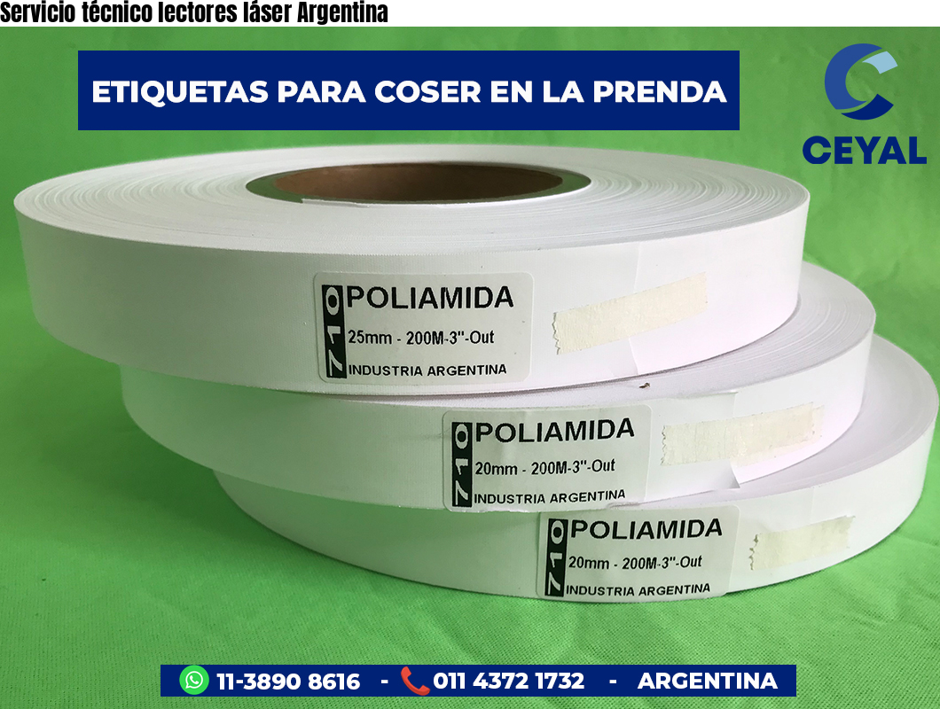 Servicio técnico lectores láser Argentina